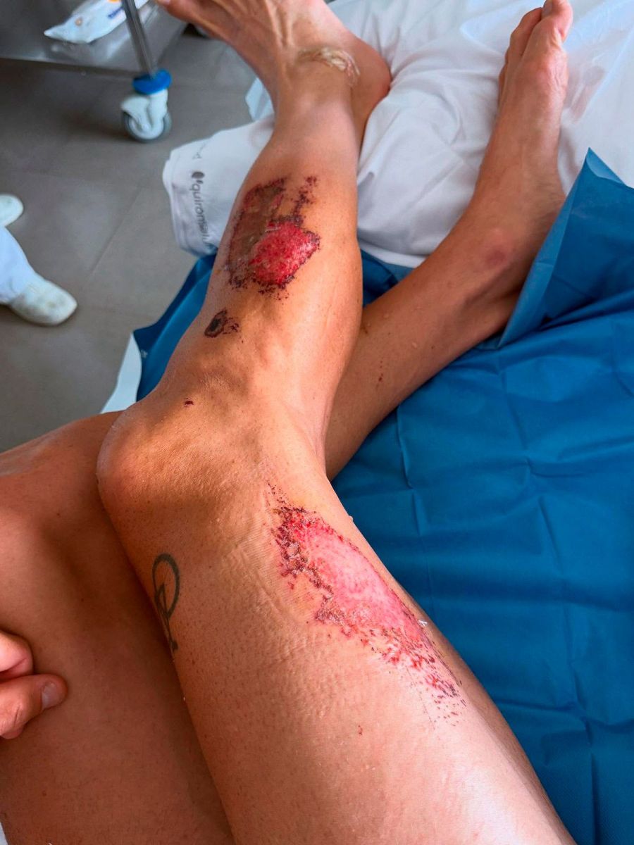 aleix espargaro