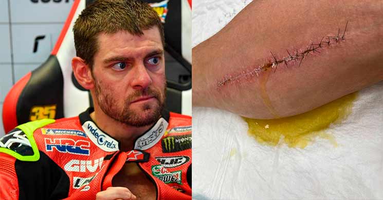 cal crutchlow