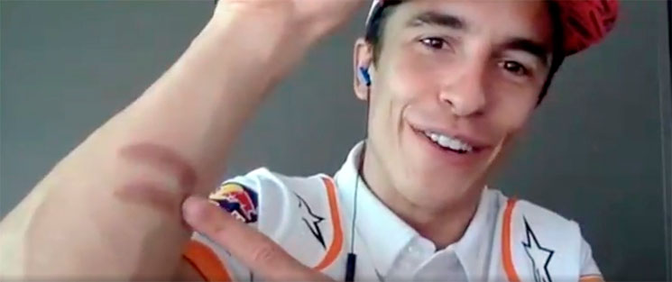 quemadura marquez