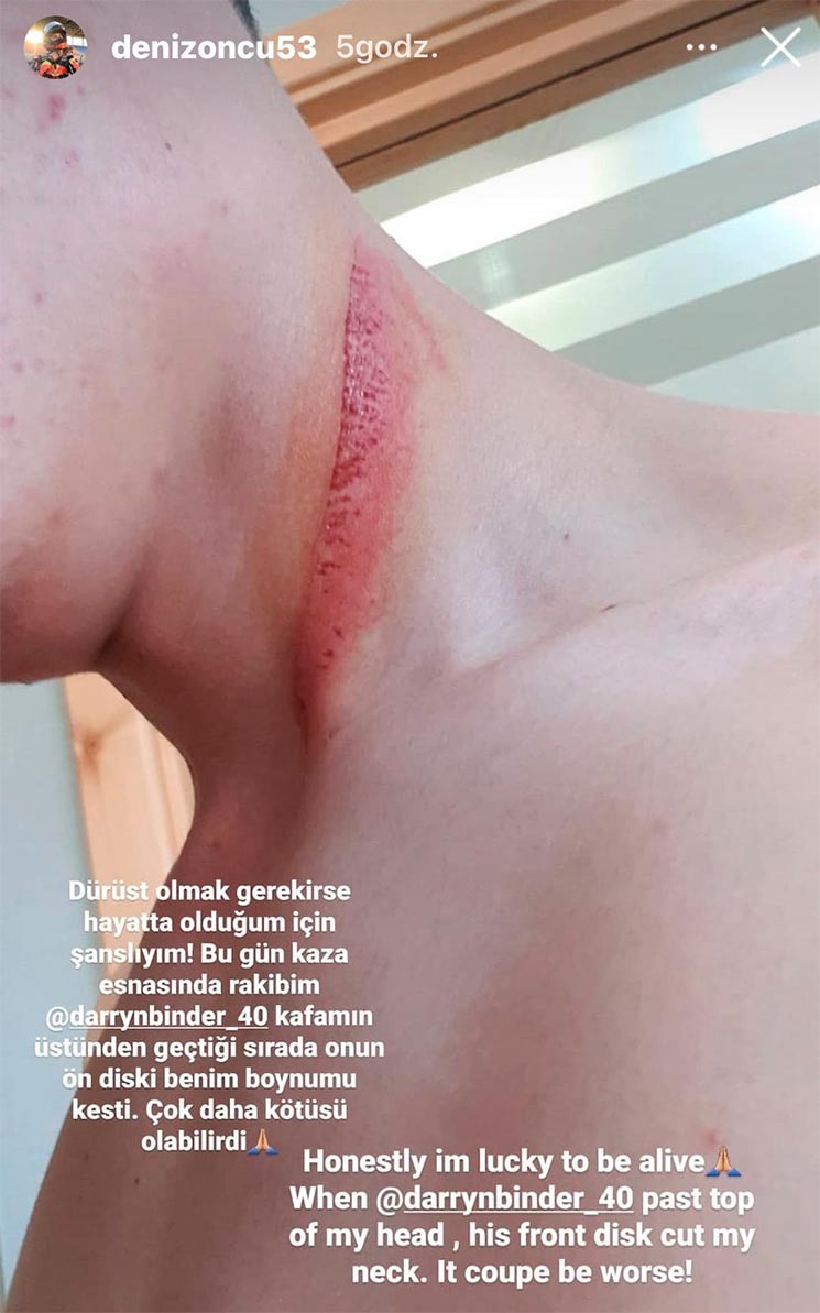 deniz oncu cuello