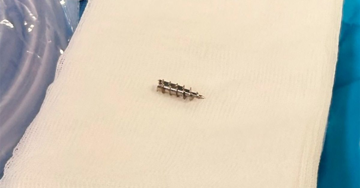 TornilloVinales_compressed