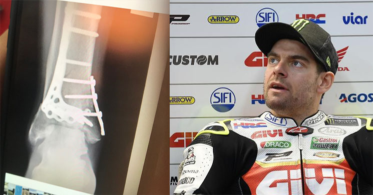 calcrutchlow-lesion-2018.jpg