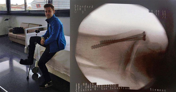 /efren-vazquez-lesion.jpg